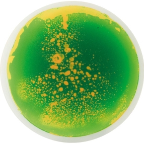 Runde Faszinationsmatten 5er Set